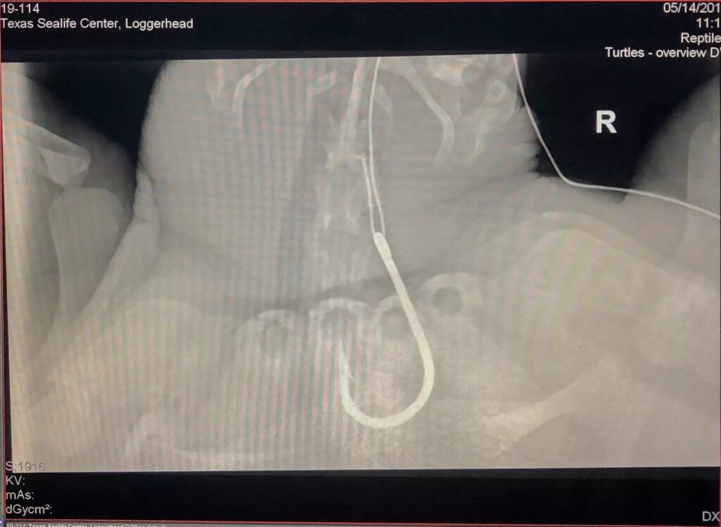 radiografia addominale