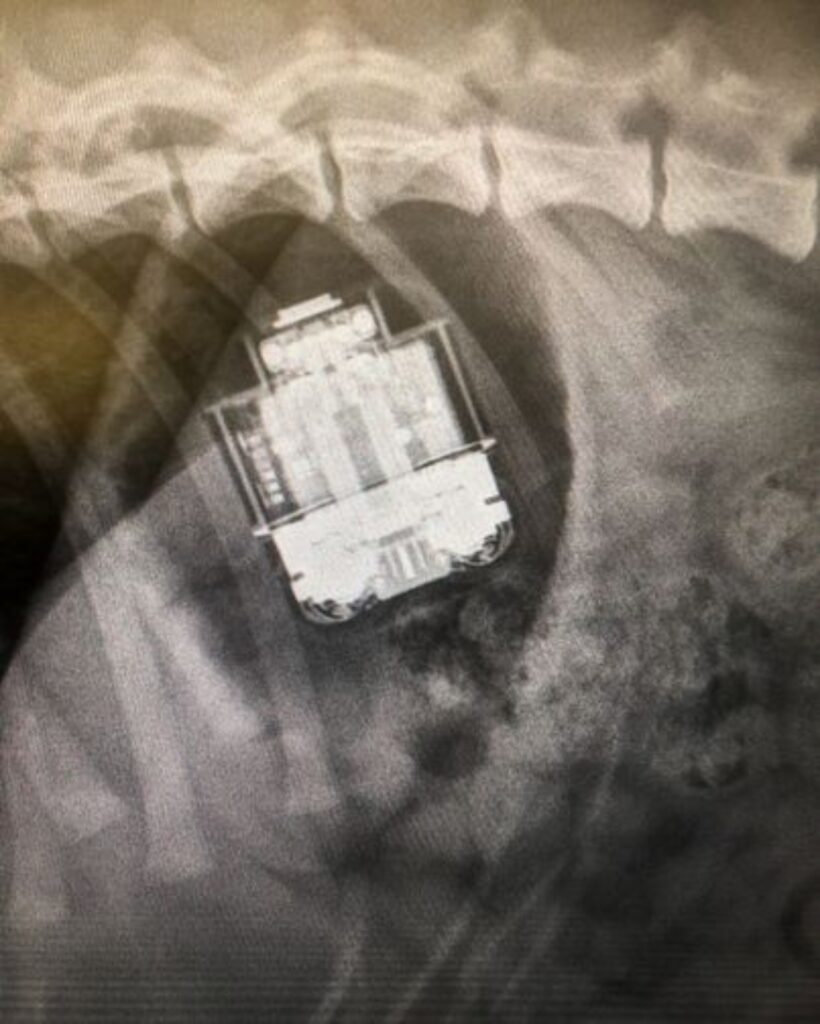 radiografia degli airpods