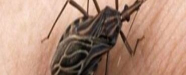 cos'è la malattia di chagas