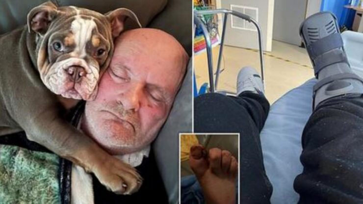 Bulldog morde l'alluce al suo padrone